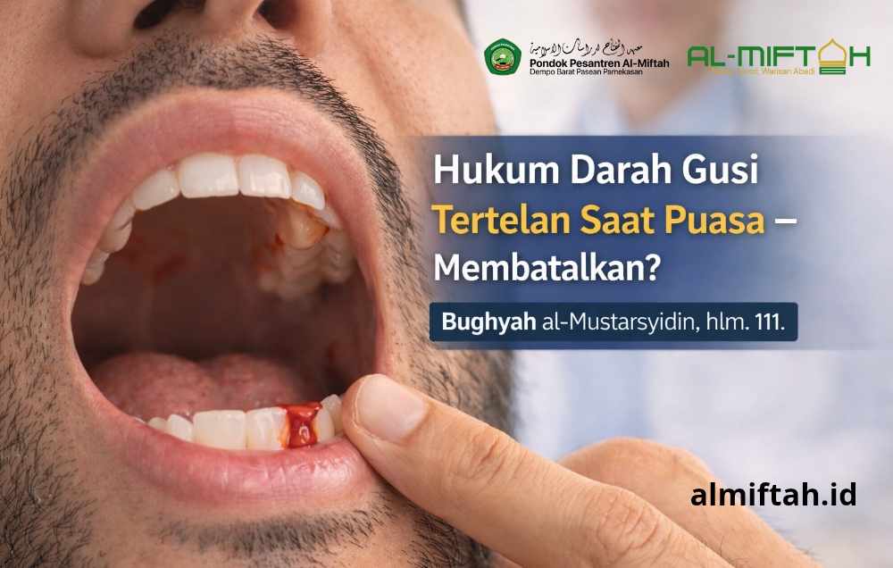 Hukum Darah Gusi Tertelan Saat Puasa